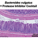 Digitized Number 2: Stool Samples Reveal Microbial Enzyme Driving Bowel Disease