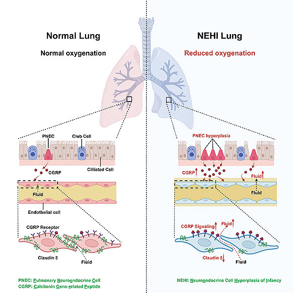 CGRP abstract