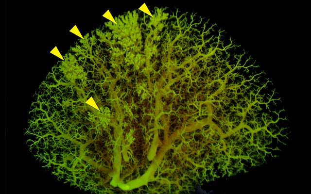 Excess Neuropeptides Disrupt Lung Function in Infant Disease and COVID-19