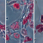 Bioengineers: Matrix Stiffness is an Essential Tool in Stem Cell Differentiation