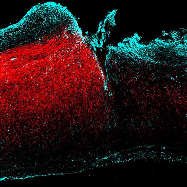 Biologists Discover New Strategy to Treat Central Nervous System Injury