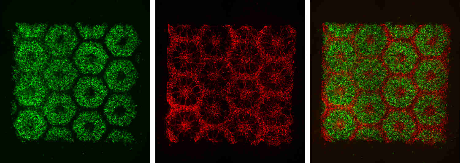 3d printed tissue