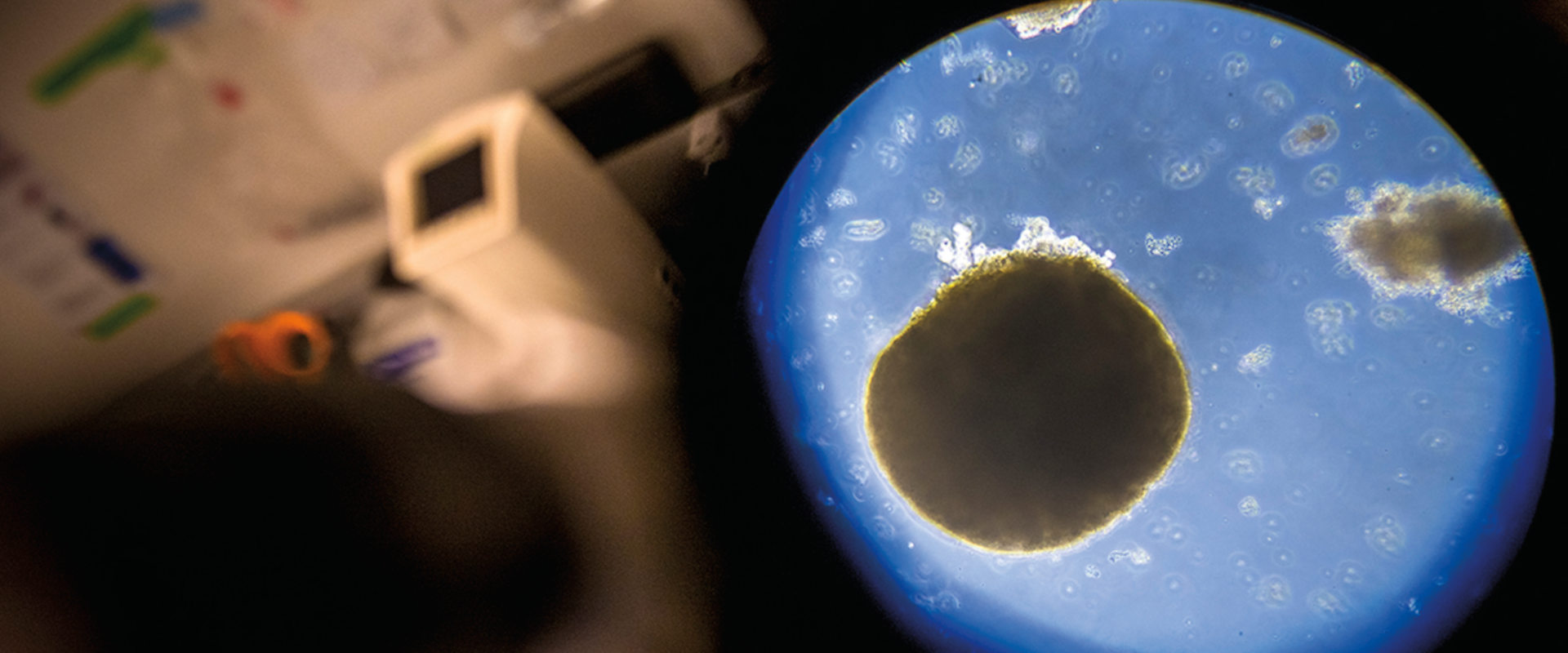 Microscopic view of human brain organoid in a petri dish