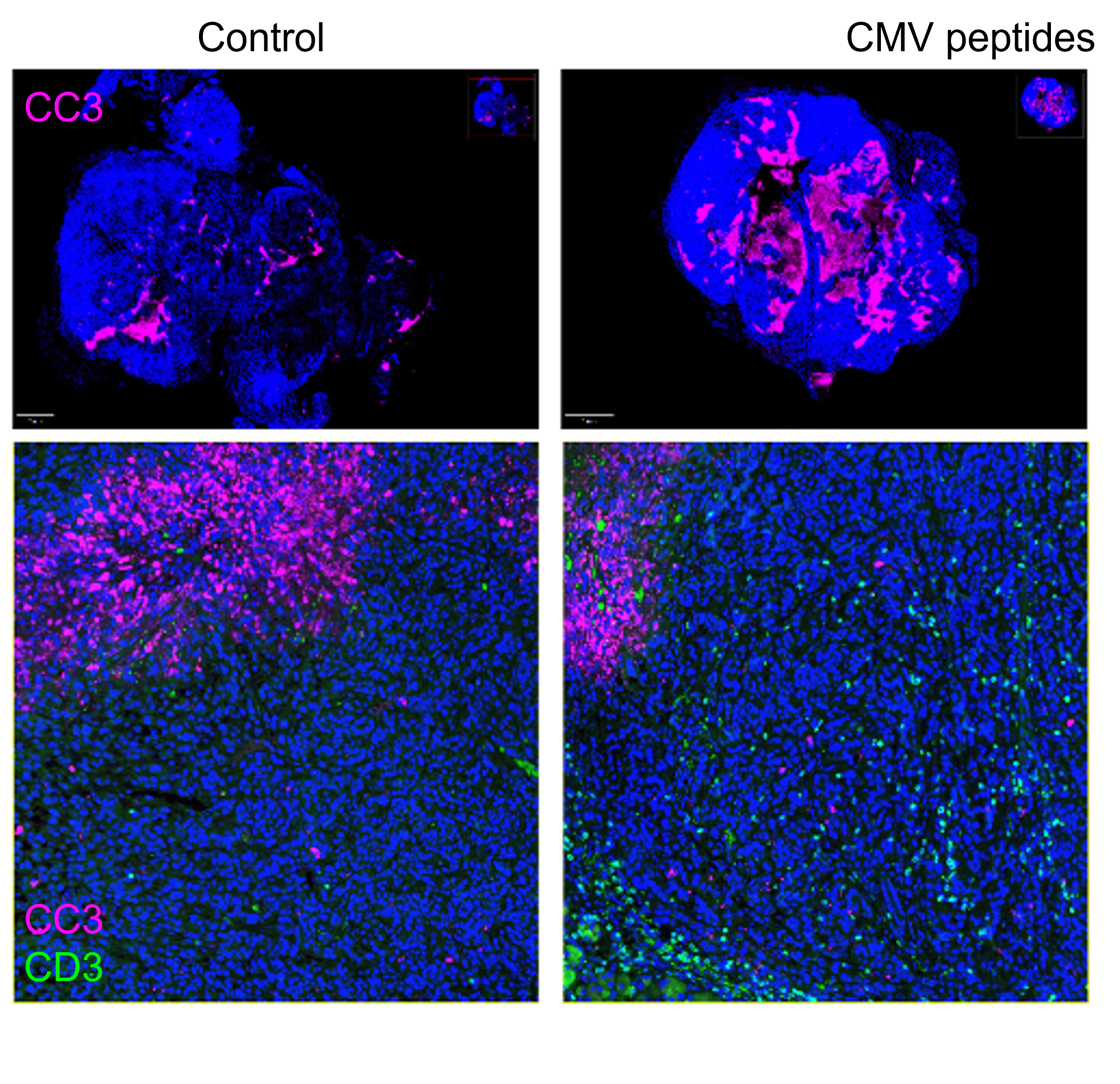 一般的ウイルスに対する免疫を膵臓がん治療に活用(Immunity Against Common Virus Leveraged Against Pancreatic Cancer)