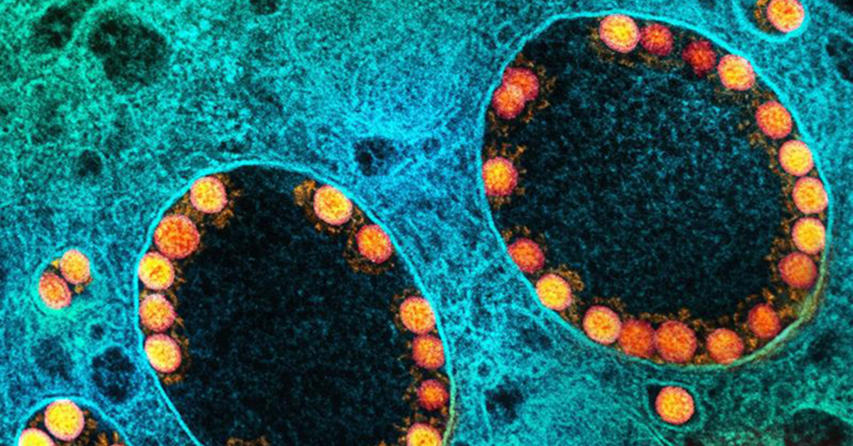 Old Molecules Show Promise for Fighting Resistant Strains of COVID