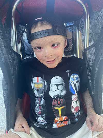 Carter before surgery