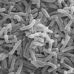 Biologists Uncover Mechanisms for Cholera Toxin’s Deadly Effects