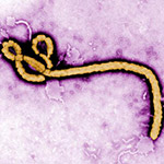 The Search for Ebola Immune Response Targets