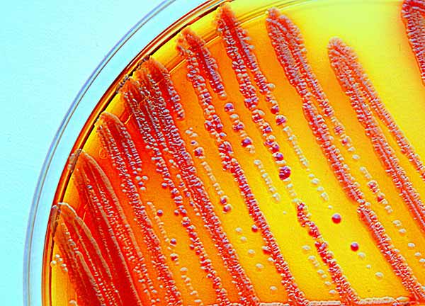 Image: Antibiotic-resistant strains of Enterobacteria