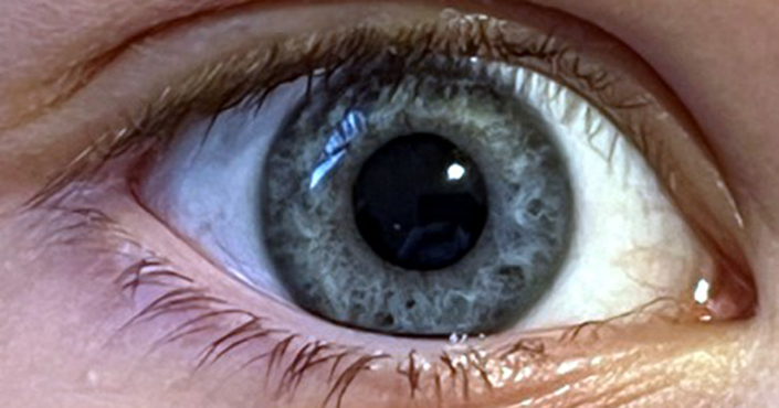 Eye close-up photo