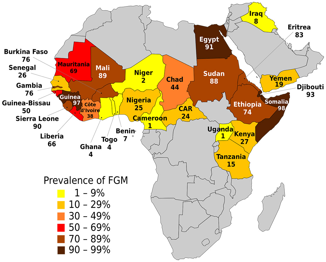Image: Prevalence of female genital mutilation for women aged 15–49 using UNICEF 'The state of the world's children 2015: Executive Summary', November 2014.
