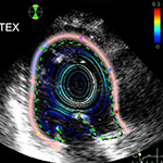 Engineers develop novel ultrasound technology to screen for heart conditions