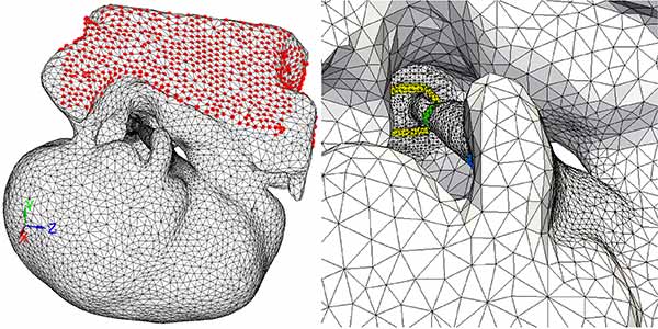 Photo: (A) Finite element mesh 4, and (B) Close-up of the ossicular chain
