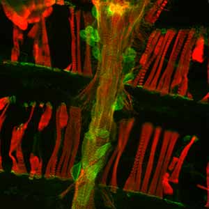 Vinculin protein boosts function in the aging heart