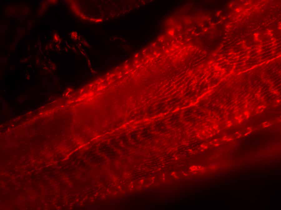 Photo: Red: β1D-integrin (an adhesion protein).