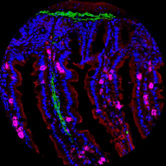 Immune Cells Anchored in Tissues Offer Unique Defenses Against Pathogens and Cancers