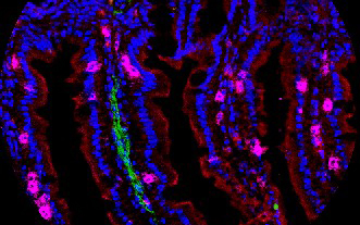 Immune Cells Anchored in Tissues Offer Unique Defenses Against Pathogens and Cancers