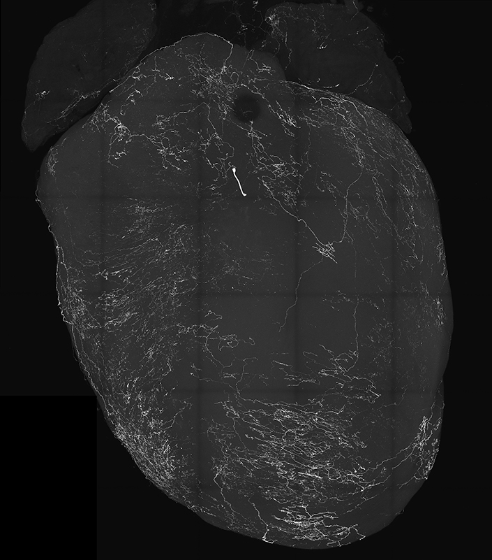 An image of a heart labeled by vagal sensory neurons.
