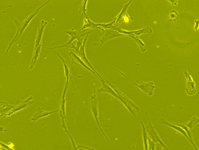 Microscopic shot of human bone marrow derived cells
