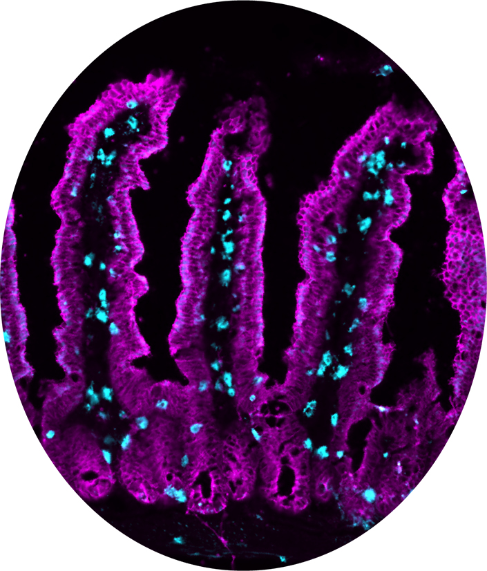 Microscopy image of specialized immune cells within the small intestines of mice.