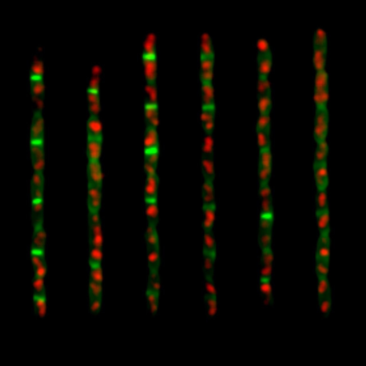 Researchers Unravel Mechanisms that Control Cell Size