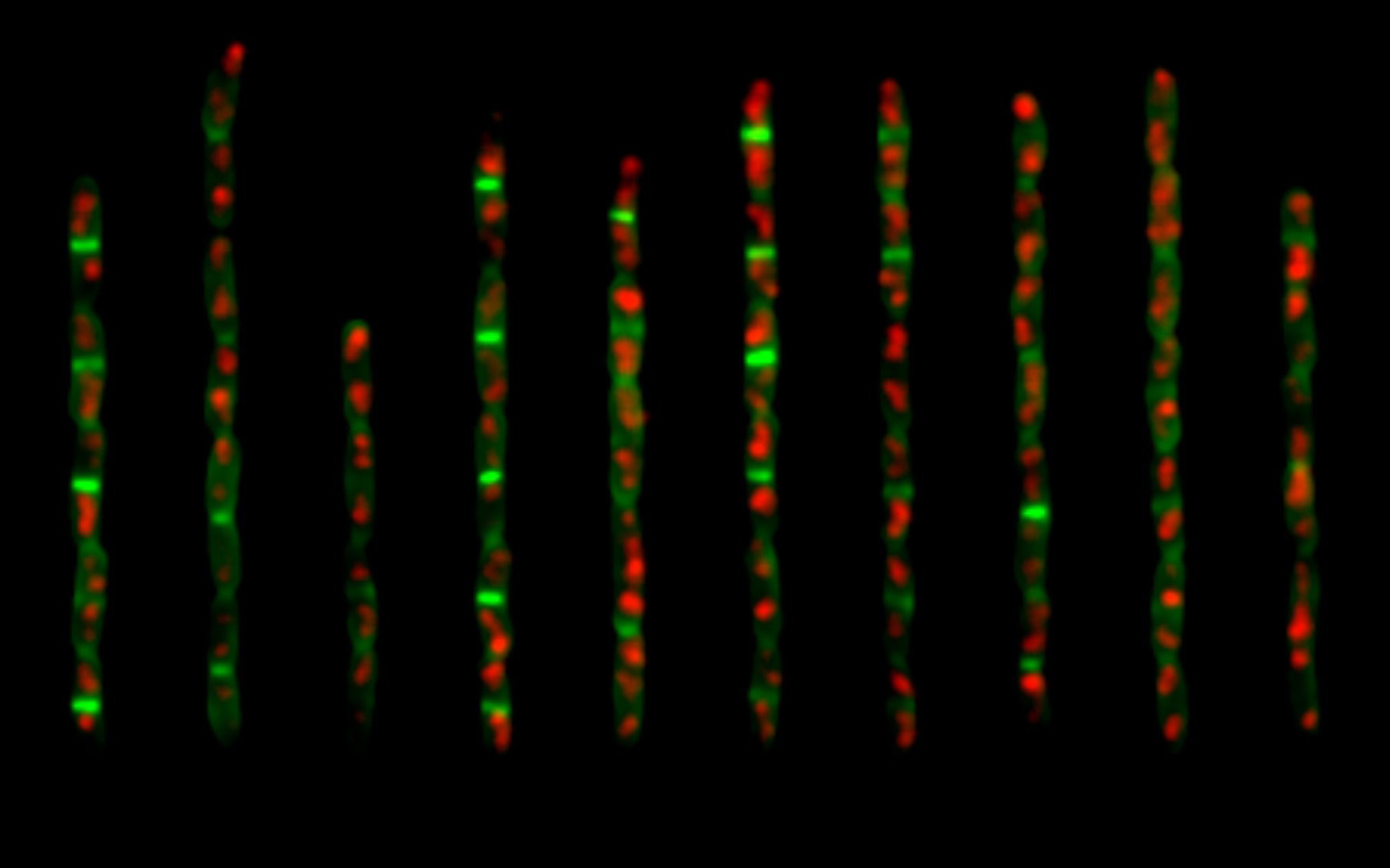 Researchers Unravel Mechanisms that Control Cell Size