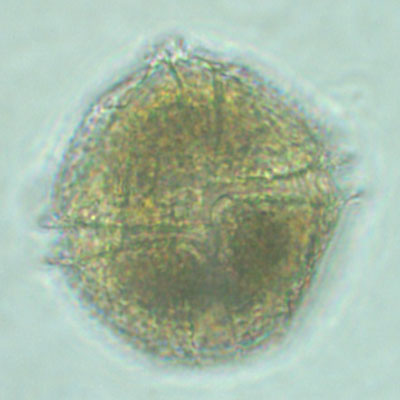 Ventral view of the dinoflagellate Lingulaulax polyedra, shown at 900x magnification.