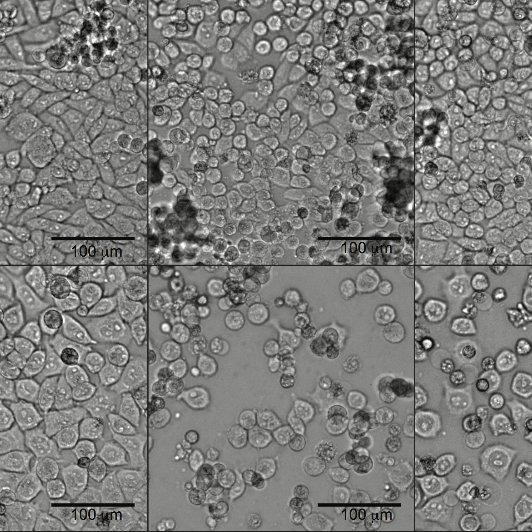 Biologists Discover Source for Boosting Tumor Cell Drug Sensitivity