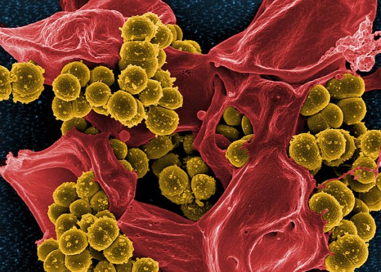 Biologists Discover New Method for Discovering Antibiotics