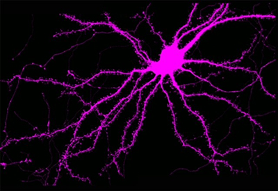 Neuron filled with fluorescent dye.