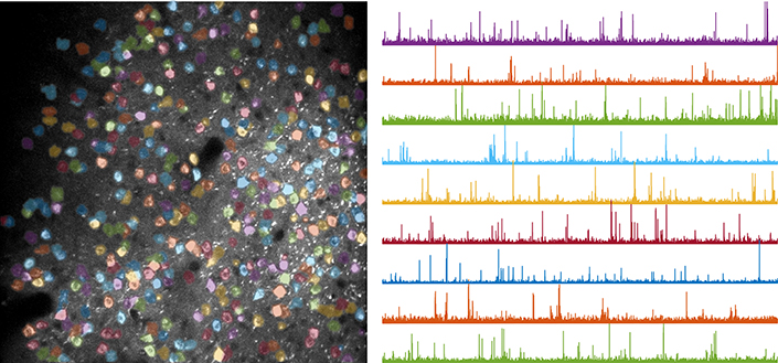 Recordings of neural activity