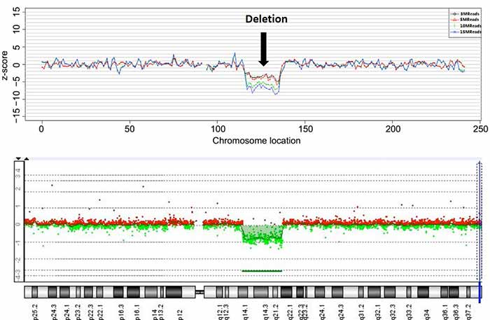 Image: Detection of chromosomal deletion by NIPT