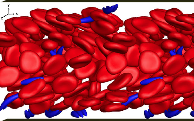 San Diego Supercomputer Center’s ‘Comet’ Aids in Sickle Cell Research Discovery