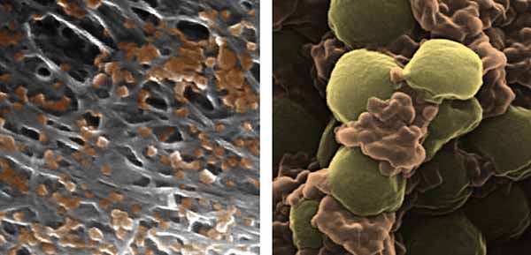 Image: Platelet-membrane-coated nanoparticles are made by coating biocompatible nanoparticle cores with the membranes of human platelets.
