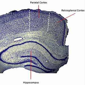 Researchers ID ‘Conjunction Junction’ for Brain’s Navigation Function