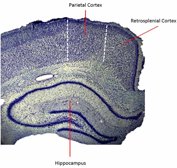 Image: The retrosplenial cortex, seen here in the rat brain, appears to be vital in helping an animal successfully navigate the world.