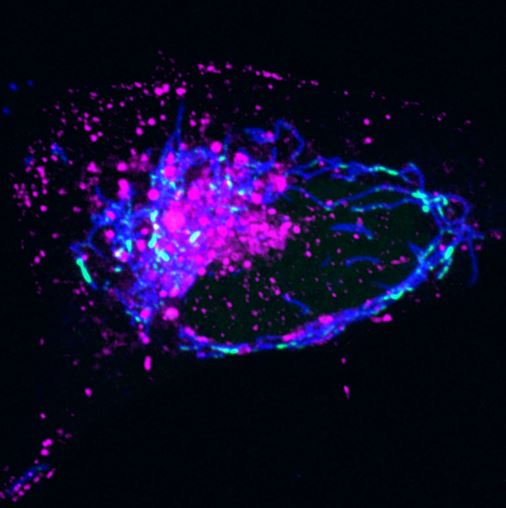 Endosomes collect around mitochondria.