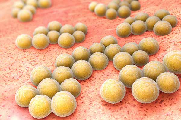 Image: Staphylococcus aureus