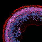 Study Uncovers Metabolic Cause for Rare Eye Disease