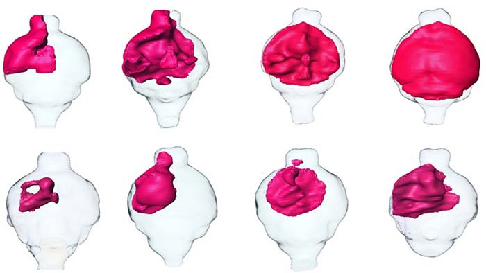 Image: MRI renderings of mouse brain tumors.