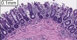 Researchers Uncover Metabolism Link to Proteins Important in Infections, Cancer and Autoimmunity