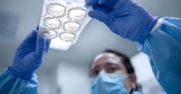 brain cortical organoids