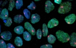UC San Diego Awarded $8M to Expand Stem Cell Therapy Clinical Trials