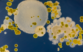 High School Students Learn the Basics of Base Editing to Cure “GFP-itis”