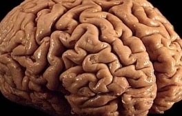 wrinkled brain