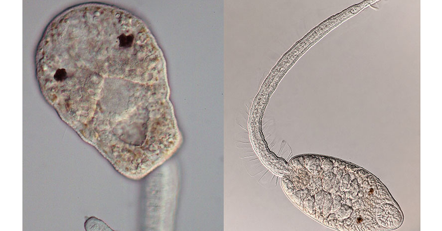 parasitic flatworms in humans