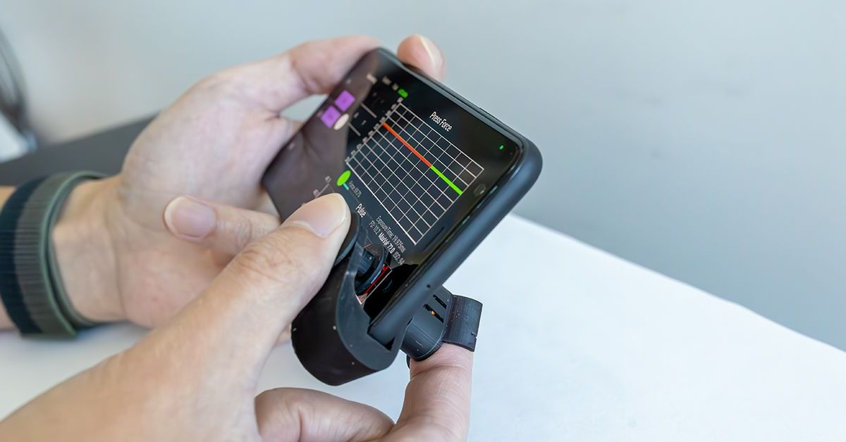 Engineers at the University of California San Diego have developed a simple, low-cost clip that uses a smartphone's camera and flash to monitor bl