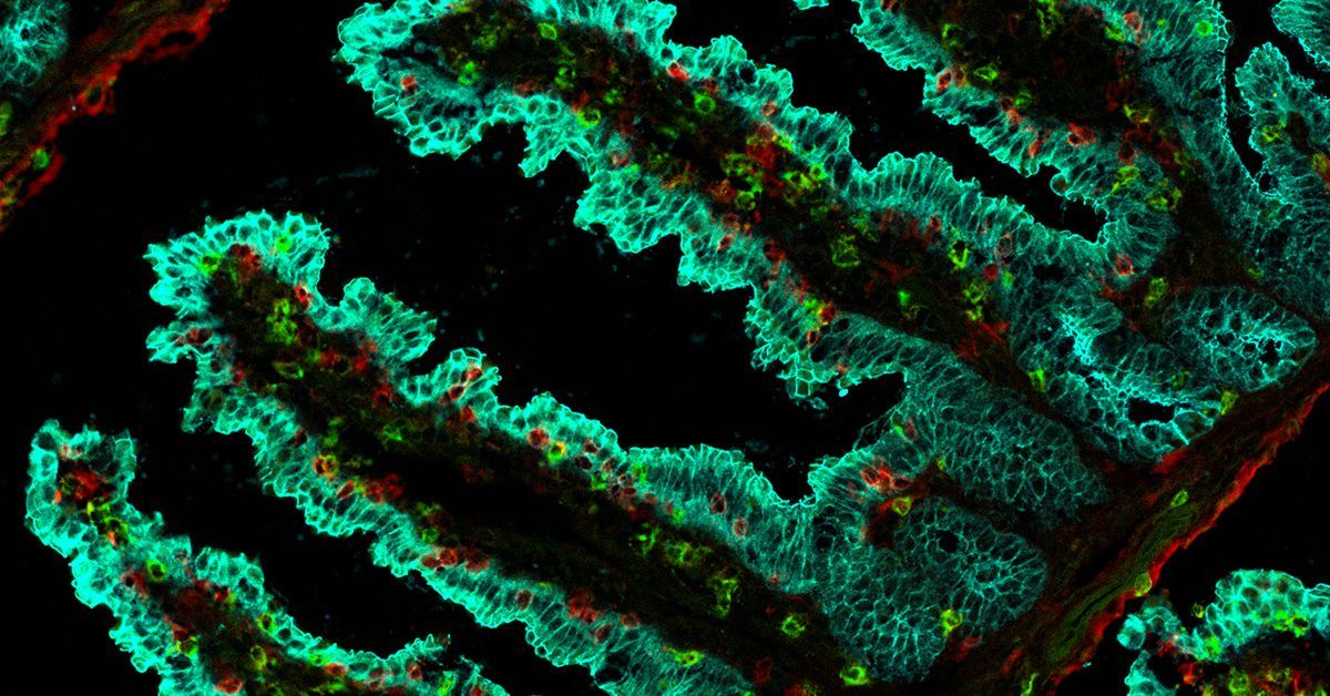 Microscopic photograph of of specialized cells of the immune system known as tissue-resident CD8 T cells .