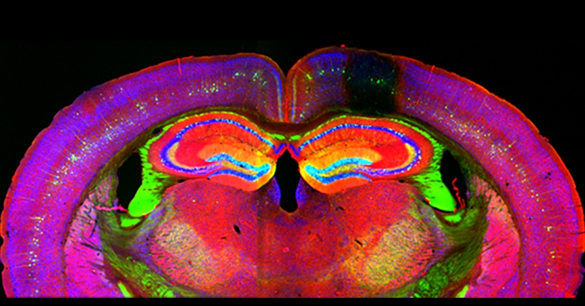 The brain taking shape