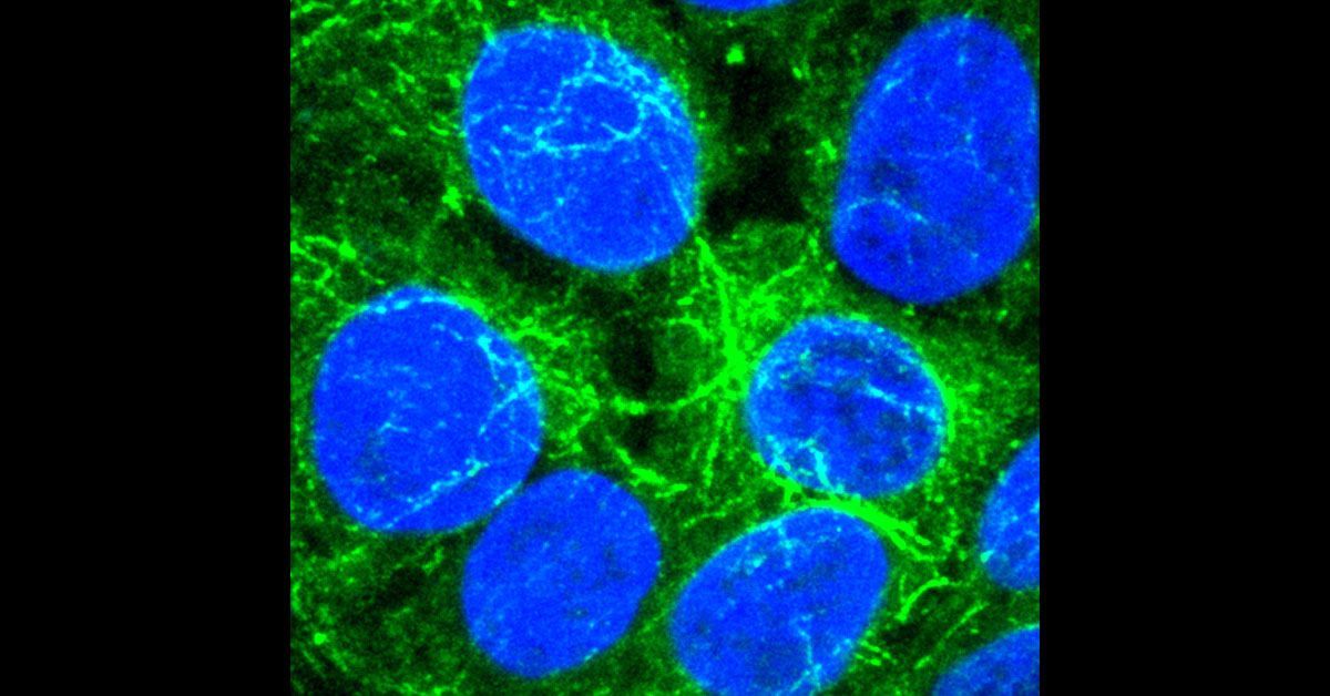 Cancer Cells Go Incognito to Cause Therapy Relapse